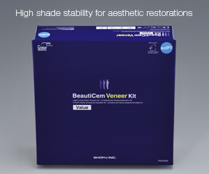 #BeautiCem #Veneer #Dental #Restoration #Aesthetic #Shofu