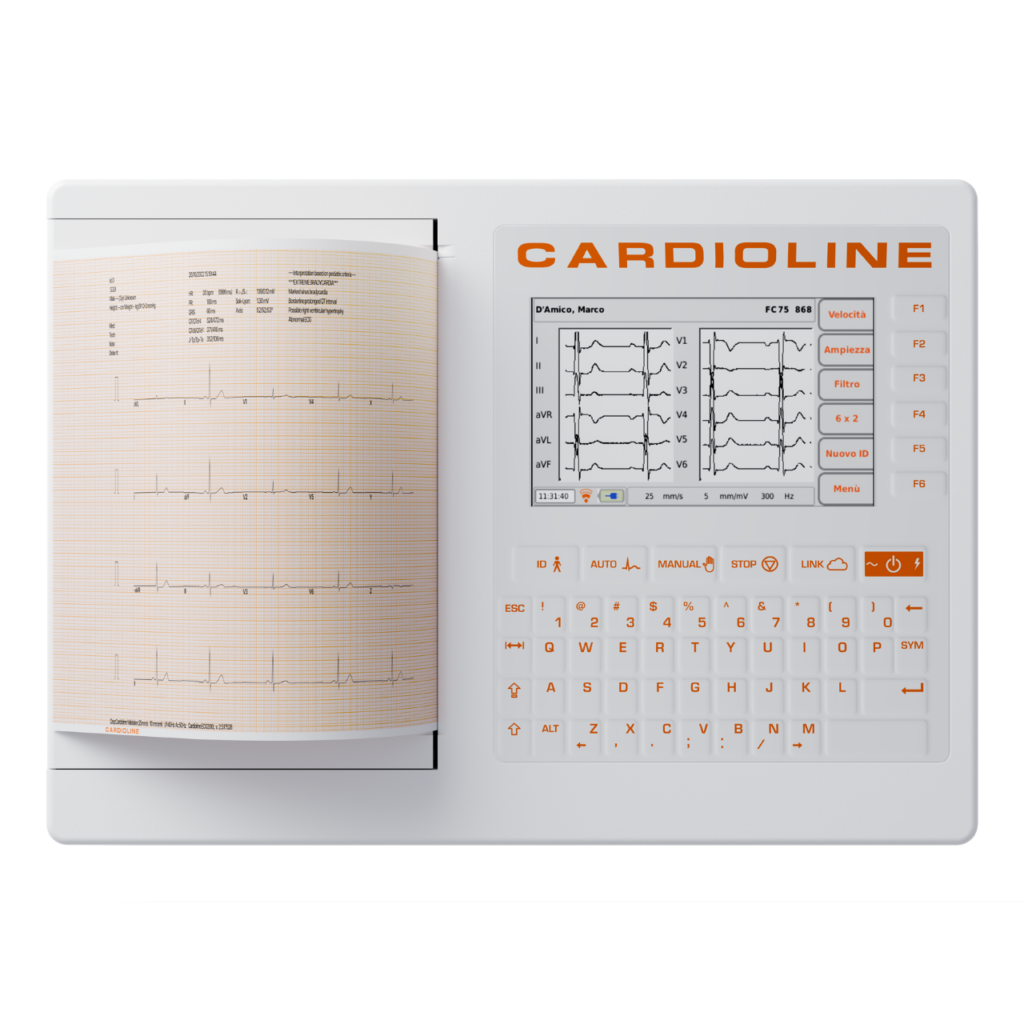 Ecg200s dieda corporation