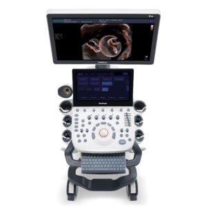 P20 SonoScape Ultrasound Technology 3D Imaging Obstetrics Medical Diagnosis
